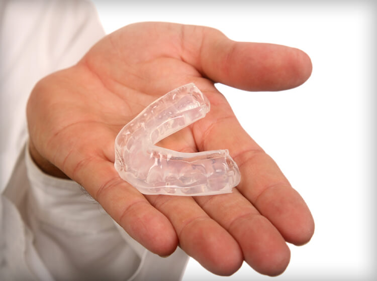 Mouth Guards